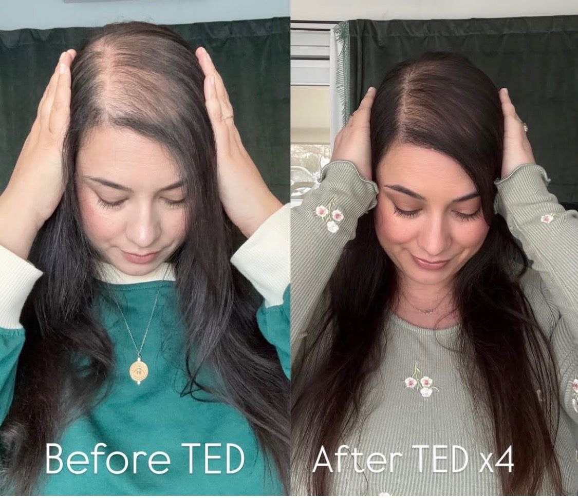 Before and After — front view