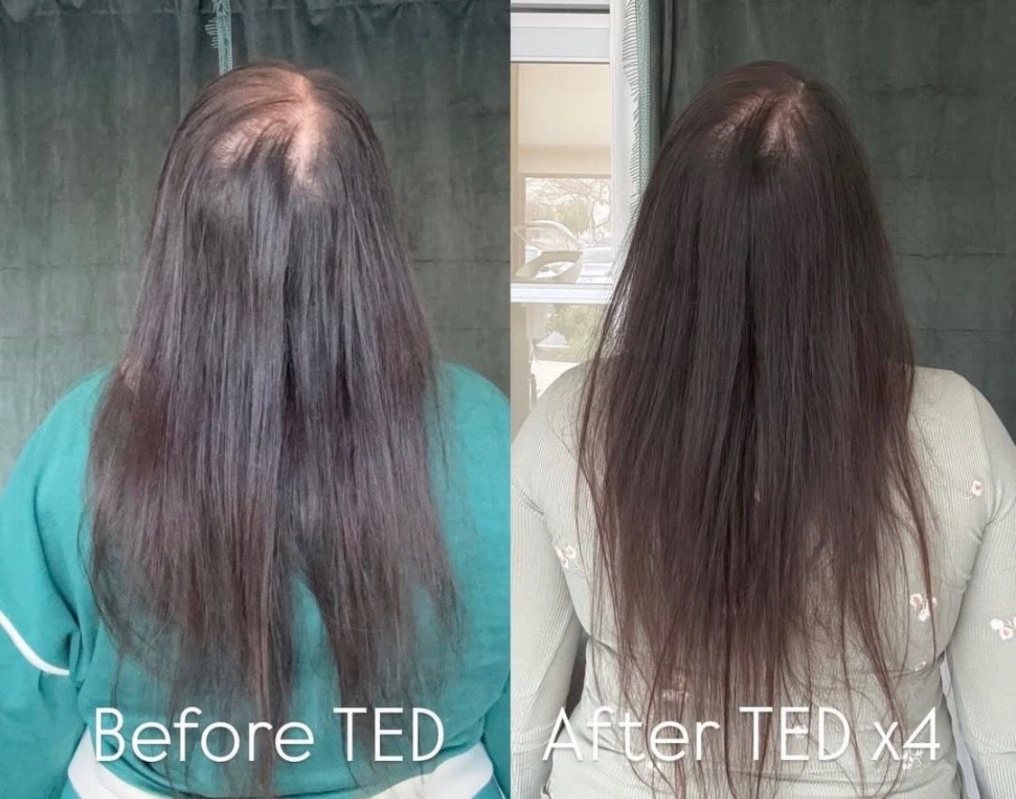 Before and After — back view