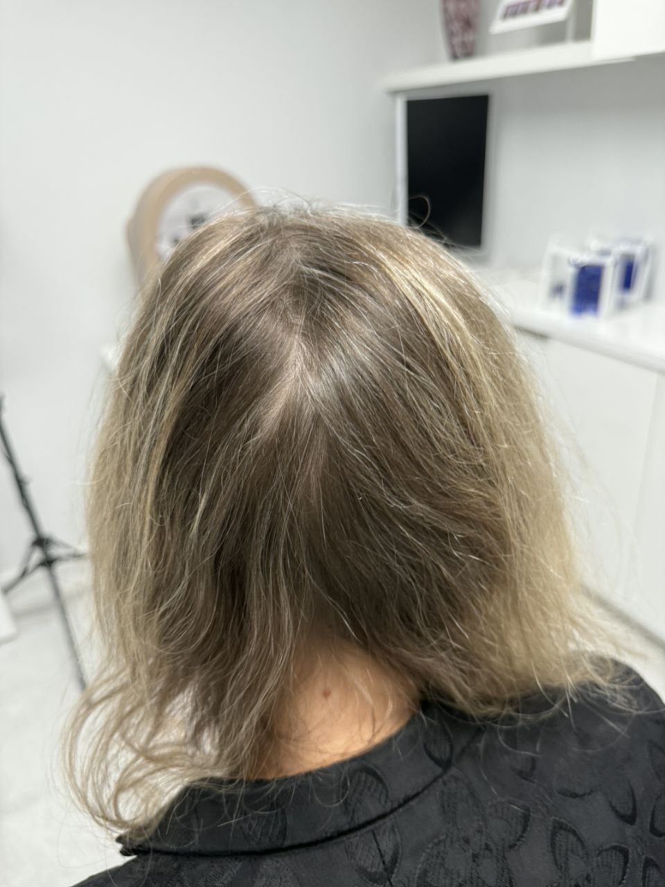 After treatment — fuller crown